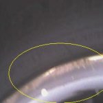 Rim Lip 2.jpg