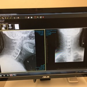 neck